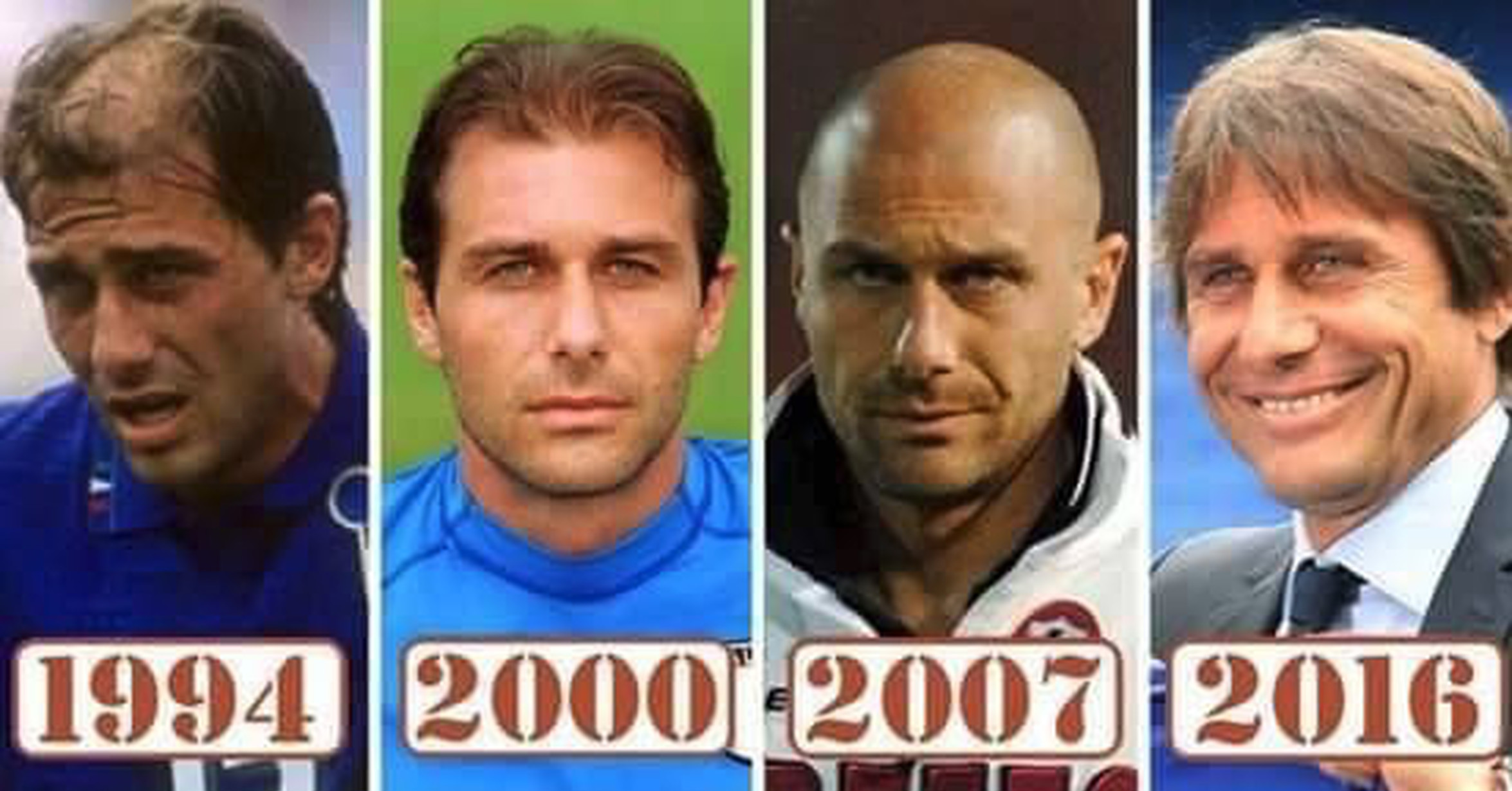 antonio conte pelo